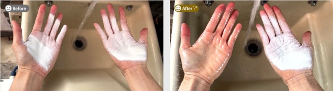 アラジンクリームの効果事例（2）