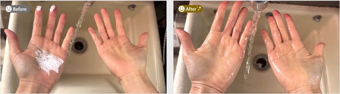 アラジンクリームの効果事例（3）